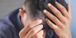 Does Gabapentin Cause Hair Loss Click Here!