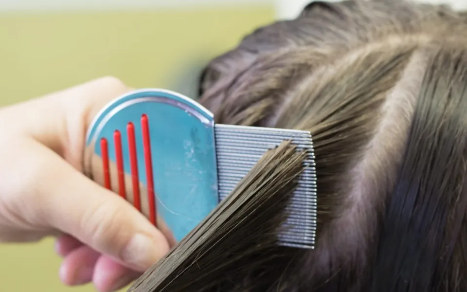 Do Lice Like Clean Or Dirty Hair? Let's See